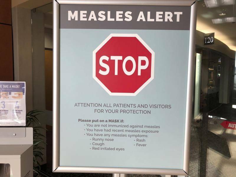 XPT patrons urged to be alert for measles